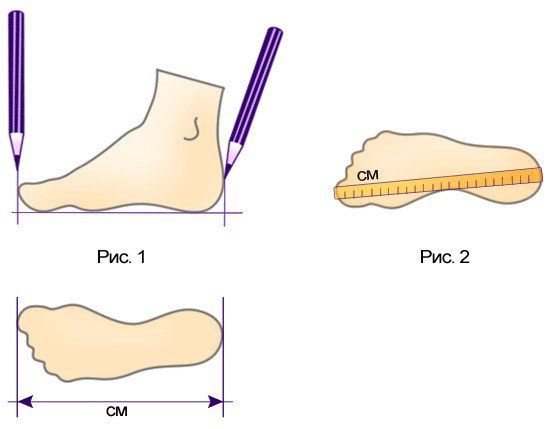 Как правильно замерить стопу и подобрать ортопедическую обувь